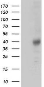 ZFP36 Antibody in Western Blot (WB)