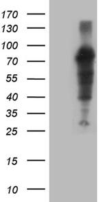 ZFP37 Antibody in Western Blot (WB)