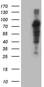 ZFP37 Antibody in Western Blot (WB)