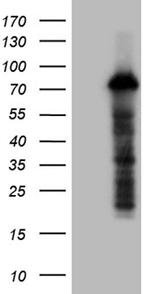 ZFP37 Antibody in Western Blot (WB)