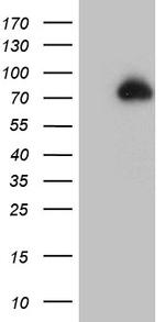 ZFP37 Antibody in Western Blot (WB)