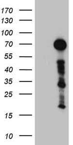 ZFP37 Antibody in Western Blot (WB)
