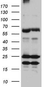 ZFP57 Antibody in Western Blot (WB)