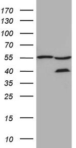 ZFYVE1 Antibody in Western Blot (WB)