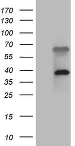 ZFYVE1 Antibody in Western Blot (WB)