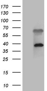 ZFYVE1 Antibody in Western Blot (WB)