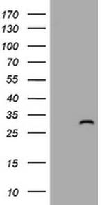 ZFYVE21 Antibody in Western Blot (WB)