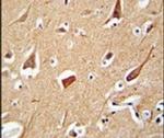 ZFYVE28 Antibody in Immunohistochemistry (IHC)