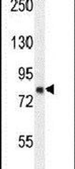 ZFYVE28 Antibody in Western Blot (WB)