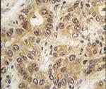 ZIC3 Antibody in Immunohistochemistry (IHC)