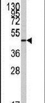 ZIC3 Antibody in Western Blot (WB)