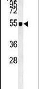 ZIC3 Antibody in Western Blot (WB)