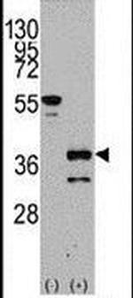 ZIC4 Antibody in Western Blot (WB)