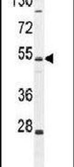 ZIK1 Antibody in Western Blot (WB)