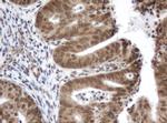 ZIM2 Antibody in Immunohistochemistry (Paraffin) (IHC (P))