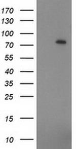 ZIM2 Antibody in Western Blot (WB)