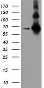ZIM2 Antibody in Western Blot (WB)