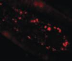 SLC39A4 Antibody in Immunocytochemistry (ICC/IF)
