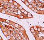 SLC39A4 Antibody in Immunohistochemistry (IHC)