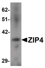 SLC39A4 Antibody in Western Blot (WB)