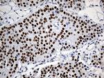 ZKSCAN1 Antibody in Immunohistochemistry (Paraffin) (IHC (P))