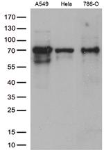 ZKSCAN1 Antibody in Western Blot (WB)