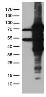 ZKSCAN1 Antibody in Western Blot (WB)