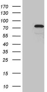 ZKSCAN1 Antibody in Western Blot (WB)