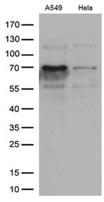 ZKSCAN1 Antibody in Western Blot (WB)