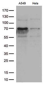 ZKSCAN1 Antibody in Western Blot (WB)