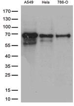 ZKSCAN1 Antibody in Western Blot (WB)