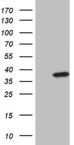 ZMAT4 Antibody in Western Blot (WB)