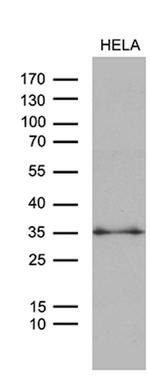 ZMAT4 Antibody in Western Blot (WB)