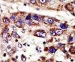ZMPSTE24 Antibody in Immunohistochemistry (IHC)