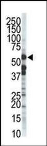 ZMPSTE24 Antibody in Western Blot (WB)