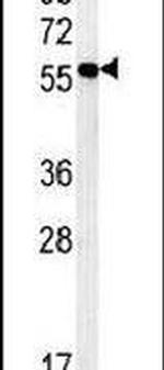 ZMYND10 Antibody in Western Blot (WB)