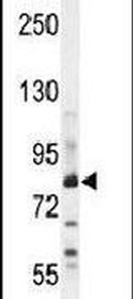 ZNF180 Antibody in Western Blot (WB)