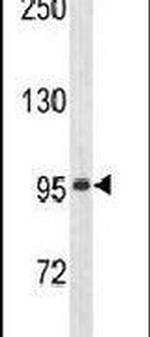 ZNF473 Antibody in Western Blot (WB)