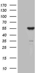 ZNF114 Antibody in Western Blot (WB)