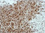 ZNF131 Antibody in Immunohistochemistry (IHC)