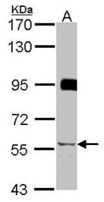 ZNF131 Antibody in Western Blot (WB)
