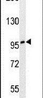 ZNF197 Antibody in Western Blot (WB)