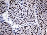 ZNF2 Antibody in Immunohistochemistry (Paraffin) (IHC (P))