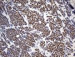 ZNF2 Antibody in Immunohistochemistry (Paraffin) (IHC (P))