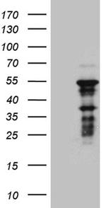 ZNF2 Antibody in Western Blot (WB)