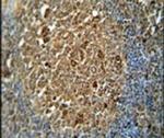ZNF20 Antibody in Immunohistochemistry (IHC)