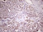 ZNF200 Antibody in Immunohistochemistry (Paraffin) (IHC (P))