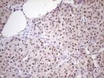 ZNF200 Antibody in Immunohistochemistry (Paraffin) (IHC (P))
