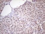 ZNF200 Antibody in Immunohistochemistry (Paraffin) (IHC (P))