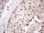 ZNF200 Antibody in Immunohistochemistry (Paraffin) (IHC (P))